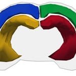 Coleen Atkins, Ph.D. Reconstruction of an Injured Brain