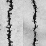 Coleen Atkins, Ph.D. Synaptic Loss after TBI