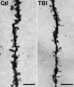 Coleen Atkins, Ph.D. Synaptic Loss after TBI
