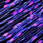 Altering host immune responses to improve the neurorepair provided by cell therapies