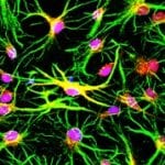 Inducing an environment for repair in the injured/diseased CNS by immunomodulation