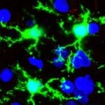 Understanding the signaling pathways involved in classical and alternative activation of microglia/macrophages